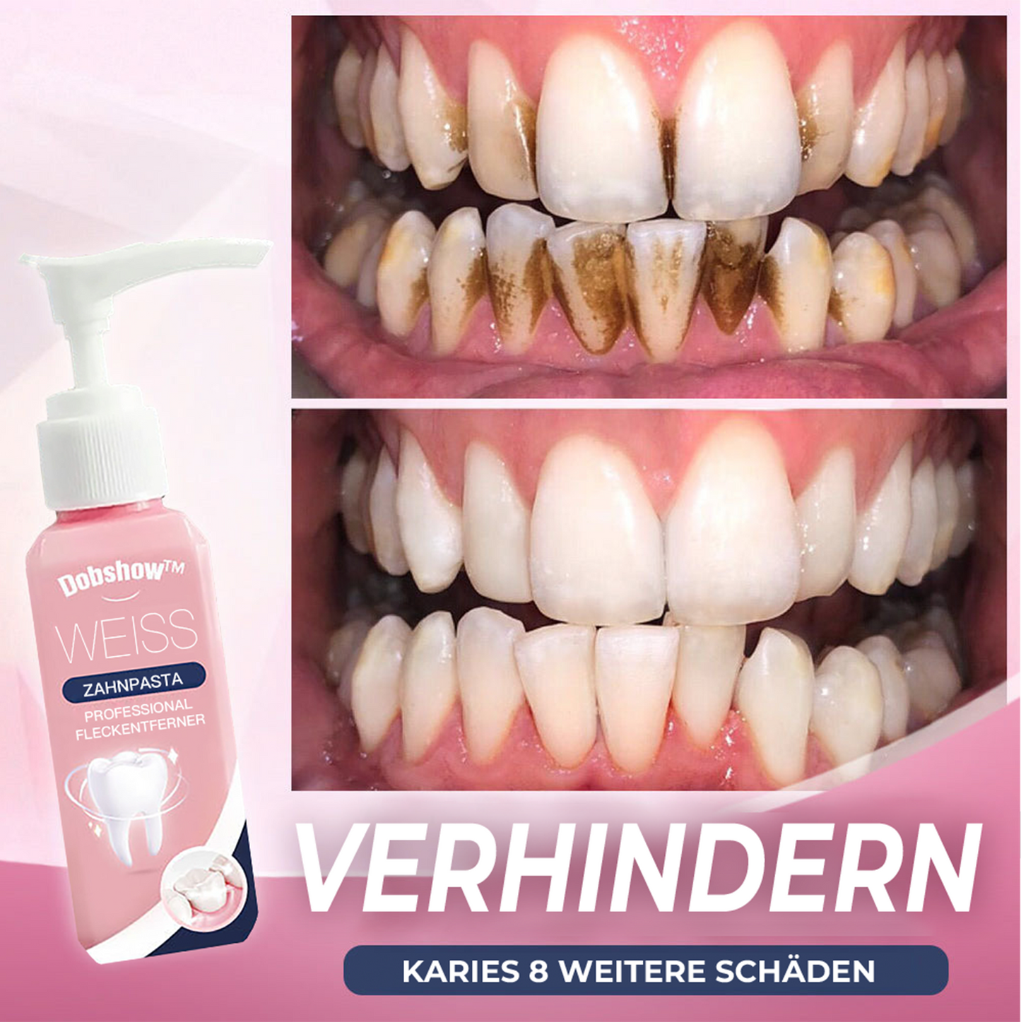 Dobshow⢠Fleckenentfernungs-Zahnpasta