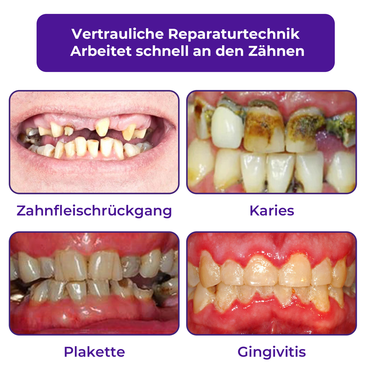 🦷Dobshow™ Zahnreparatur-Mineralpulver >> 🔥1+1 Gratis🔥