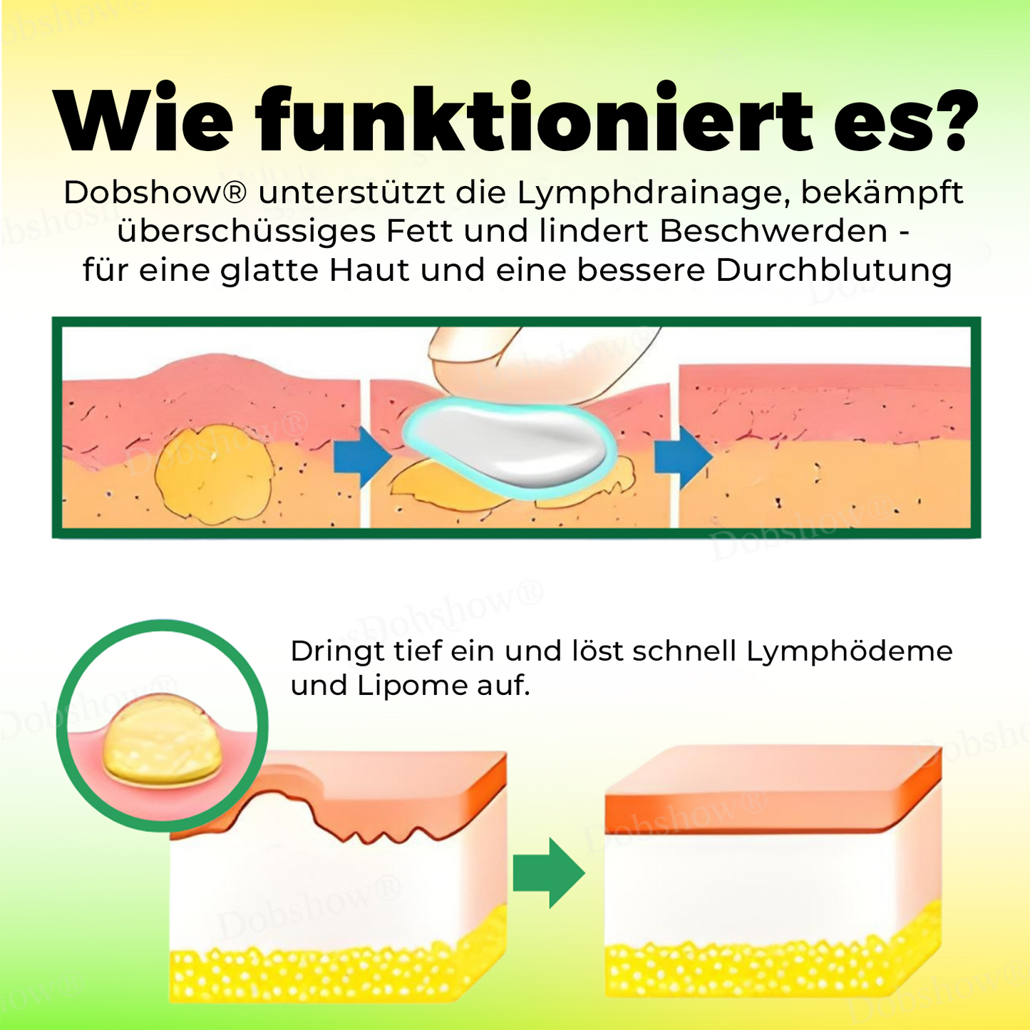 🐝Dobshow® Bienengift Lymphdrainage-Creme