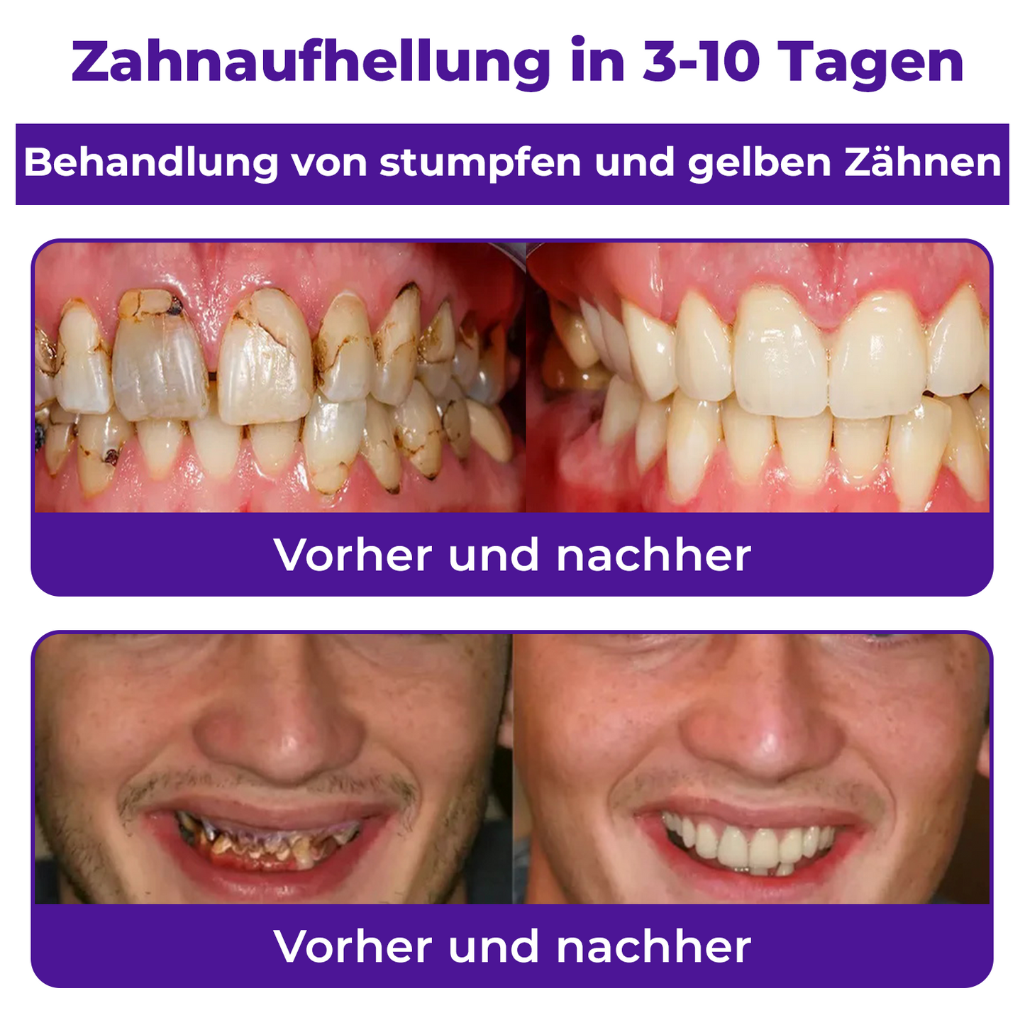 🦷Dobshow™ Zahnreparatur-Mineralpulver >> 🔥1+1 Gratis🔥