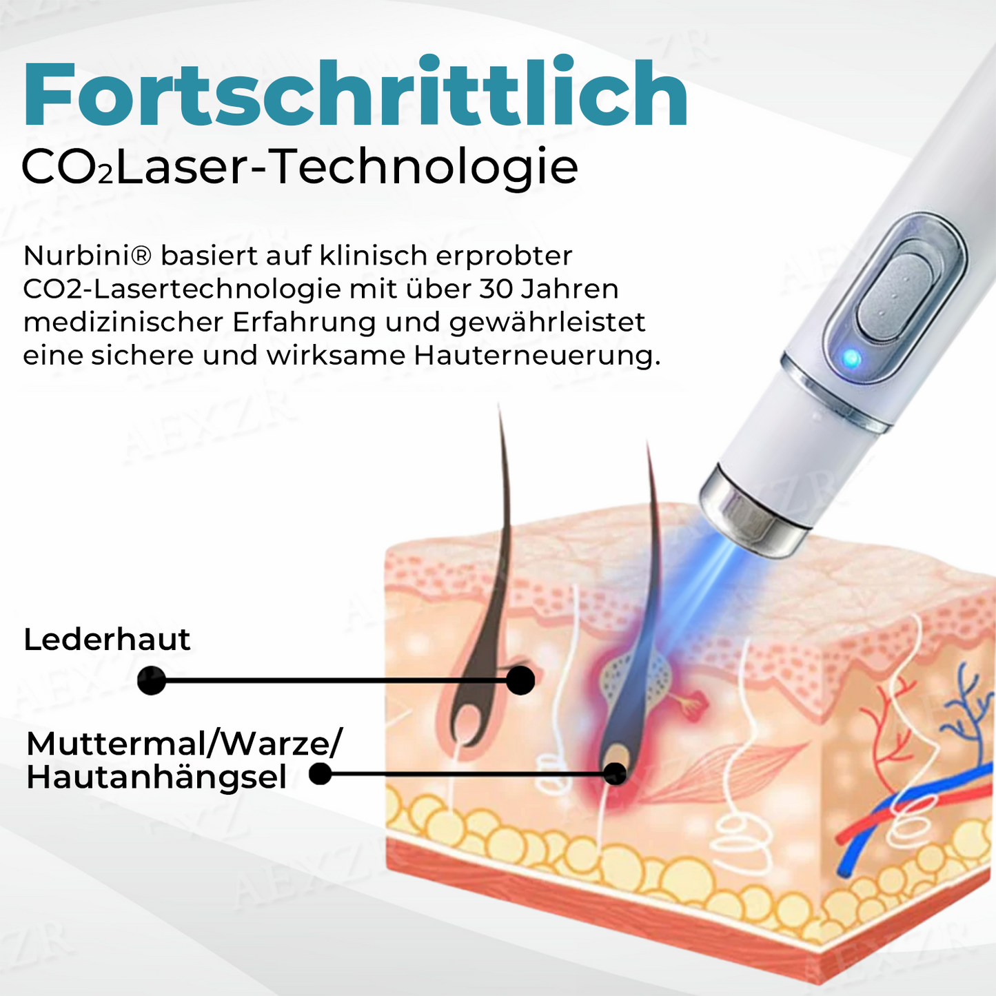 ✨Nurbini® Nicht-invasiver Laser-Stift zur Entfernung von Muttermalen und Warzen✨