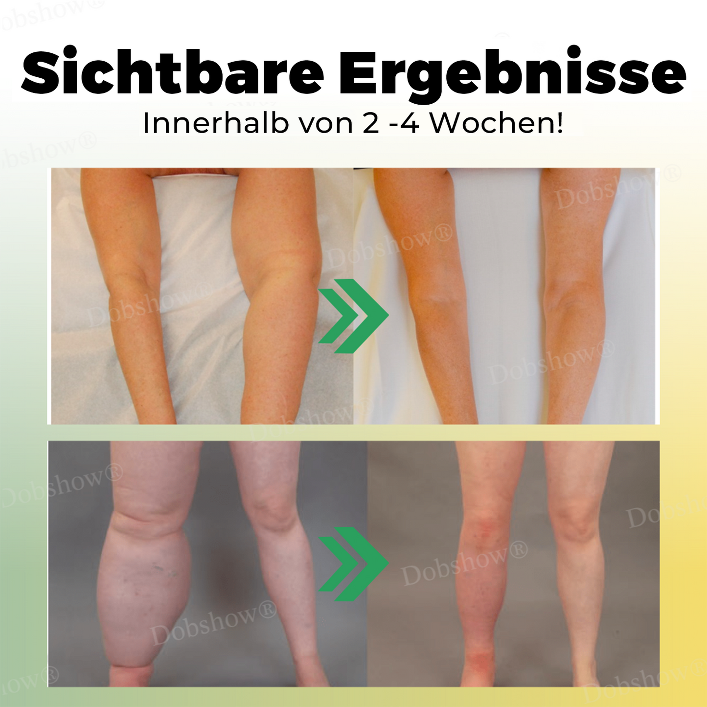 🐝Dobshow® Bienengift Lymphdrainage-Creme