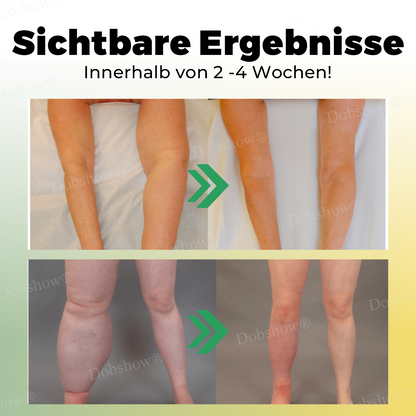 🐝Dobshow® Bienengift Lymphdrainage-Creme